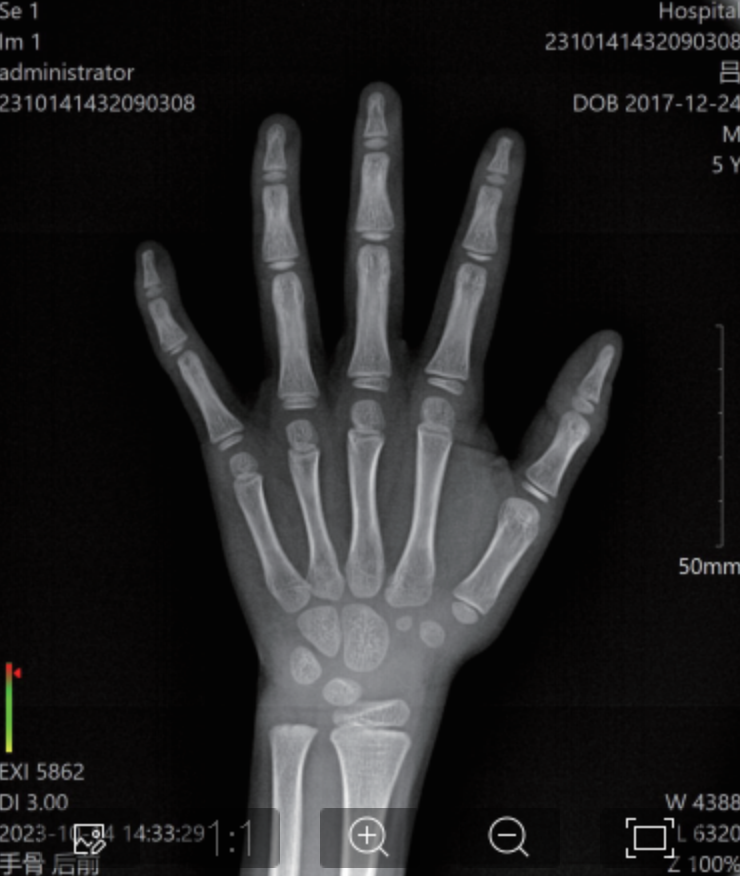 手部X光图像