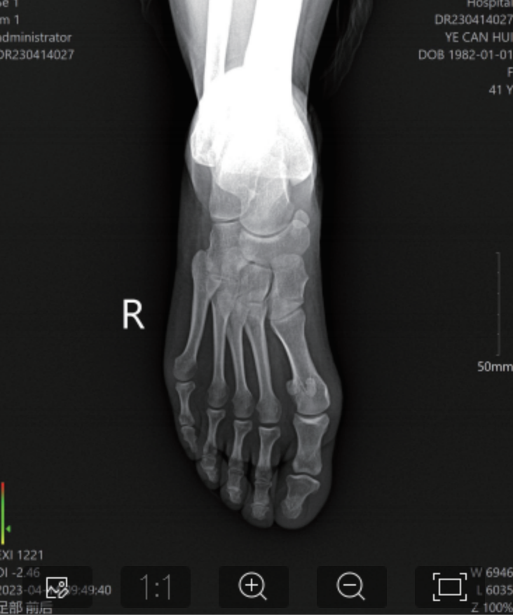 足部X光图像